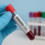 تفسیر آزمایش آمونیاک Ammonia NH3