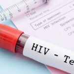 آنتی بادی اچ.آی. وی  ( HIV Antibody  )