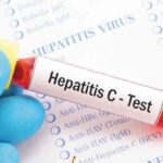 هپاتیت سی  ( Hepatitis C  )