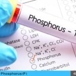 تفسیر آزمایش فسفر  ( Phosphorus  )